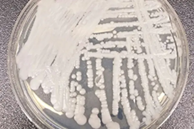 C. auris, a fungus resistant to many medications, cultured in a petri dish at a CDC laboratory.